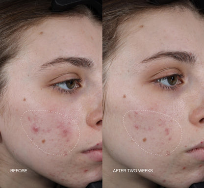 Faded Brightening & Clearing Serum